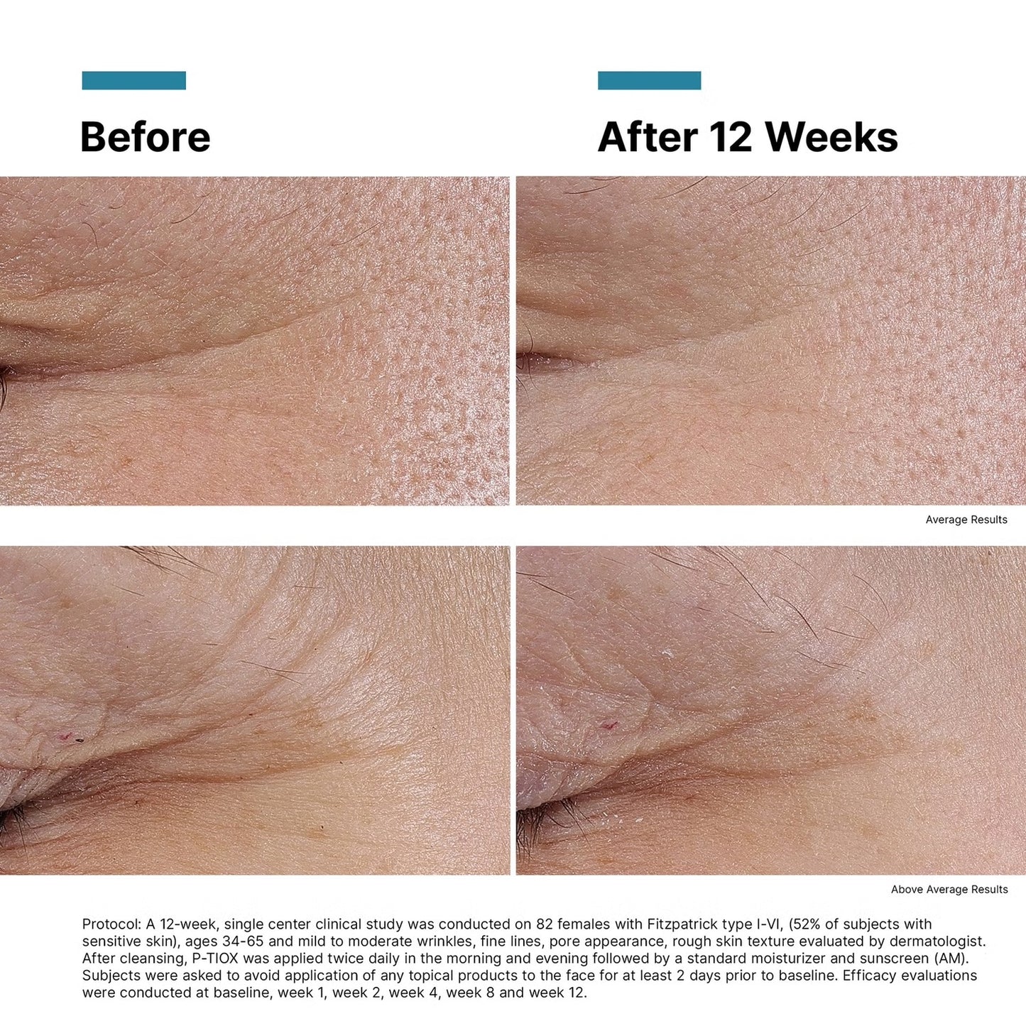 SkinCeuticals P-TIOX Anti-Wrinkle Peptide Serum