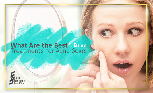 What Are the Best Acne Scar Treatments?